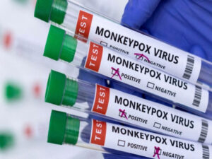 Cidade do Rio tem transmissão local de varíola dos macacos