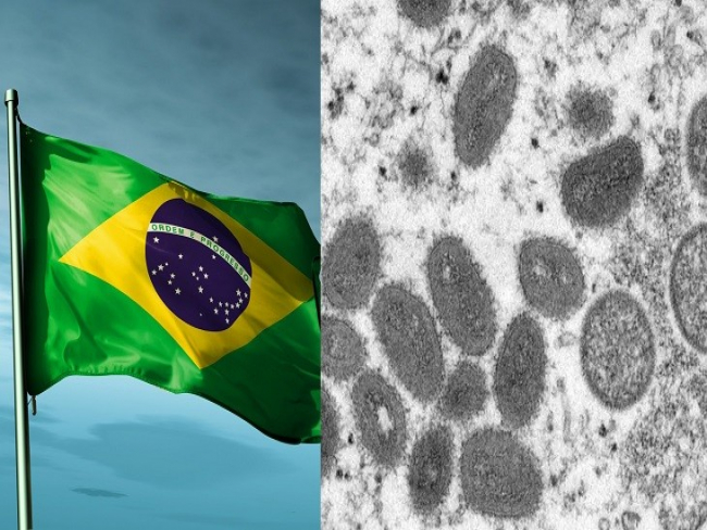 Confirmado o primeiro caso de varíola dos macacos no Brasil