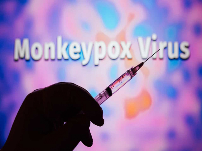Sobe para 328 o número de casos de Monkeypox em Portugal