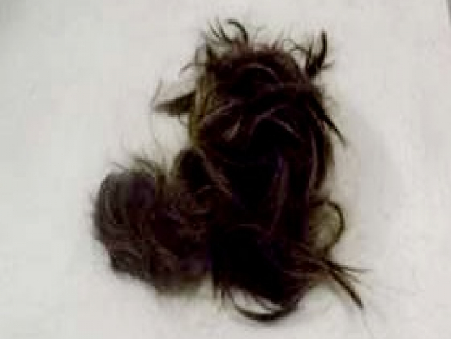 TORTURA: Mulher é agredida e tem cabelo cortado com faca pelo ex marido   Rondoniaovivo.com