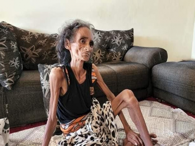 TRISTEZA: Morre idosa que não tinha documentos e lutava por tratamento de câncer    Rondoniaovivo.com
