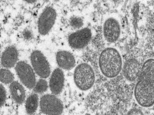 USP cultiva vírus da varíola dos macacos para expandir testes