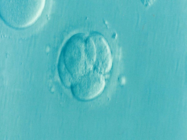 Número de embriões congelados mais que triplica no Brasil