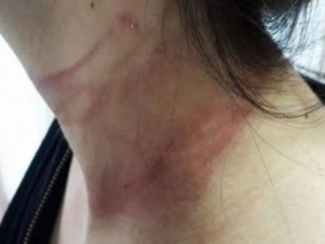 EMBRIAGADO: Policial civil aposentado é acusado de agredir a mulher ao chegar em casa    Rondoniaovivo.com