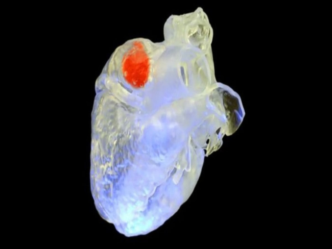Cientistas usam ultrassom para imprimir em 3D dentro do corpo humano