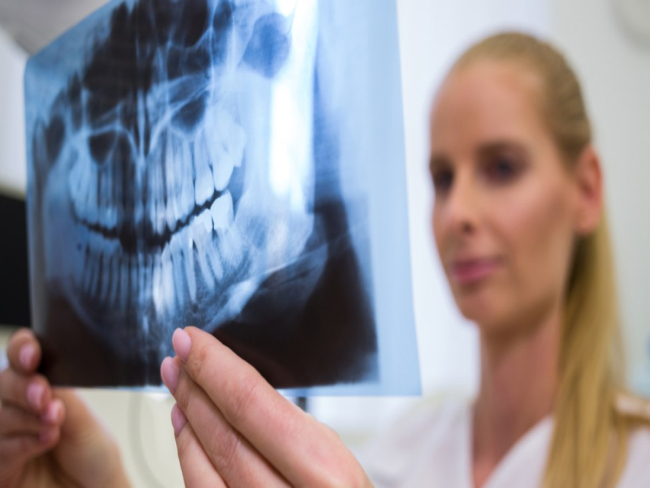 HPV na boca: um alerta silencioso