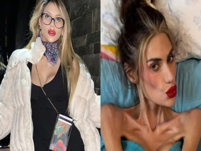 Morte de influenciadora de 22 kg reacende debate sobre beleza