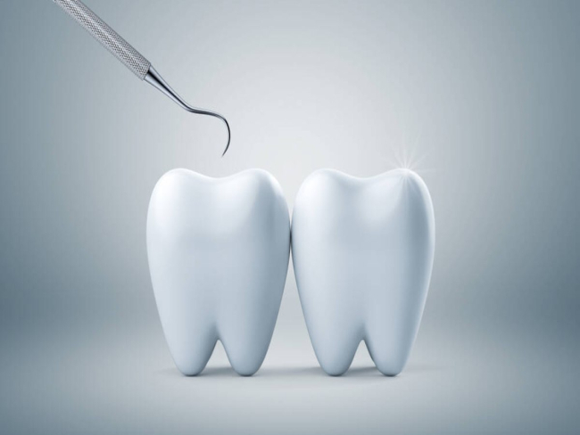 Saúde bucal: cuidados essenciais após a extração dental