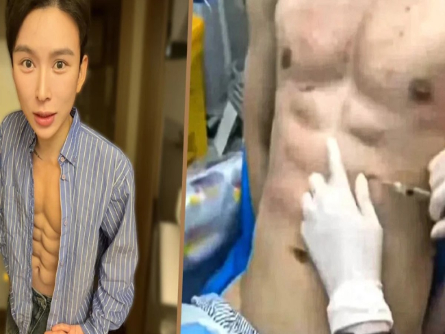 Homem gasta quase R$ 3 milhões para ter abdômen definido