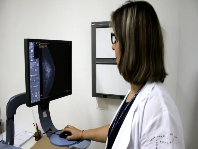 Mamografia agora é recomendada para mulheres a partir dos 40