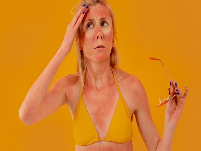 Insolação pode causar danos permanentes e elevar risco de câncer