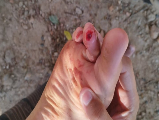 Adolescentes são feridos por piranhas em lago turístico de GO