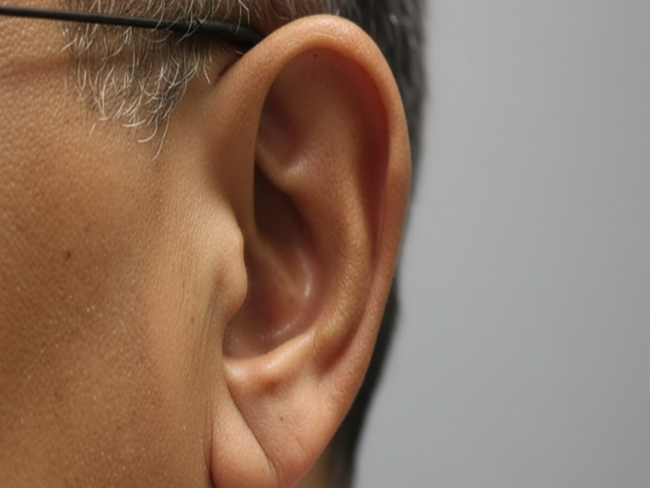 Sinal de Frank: o que ele pode revelar sobre risco cardiovascular