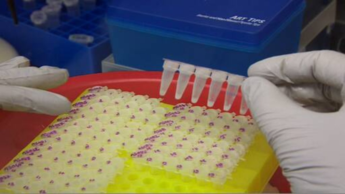 Paciente com suspeita de Ebola é diagnosticado com meningite