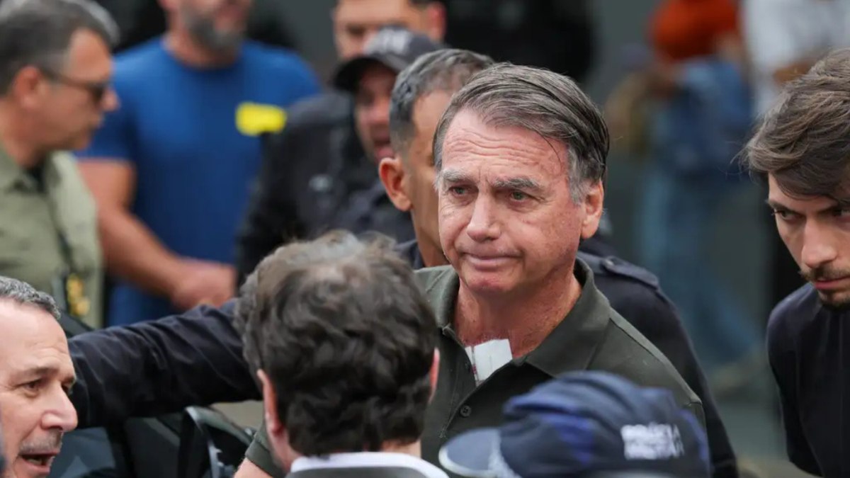 36 horas de soluço: médicos revelam estado de saúde de Bolsonaro