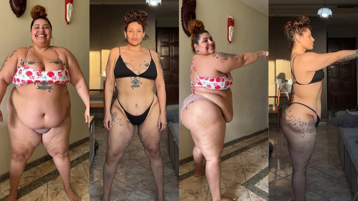 Ex The Voice perde 90 kg e revela resultado após cirurgia