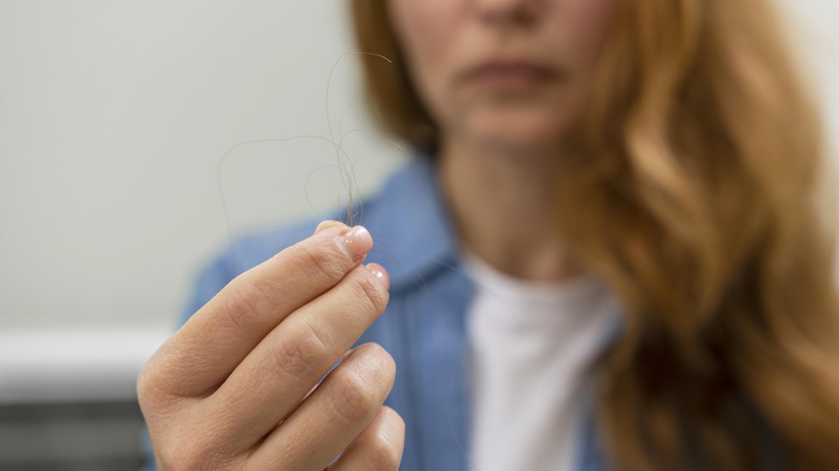 Queda de cabelo após canetas emagrecedoras preocupa mulheres